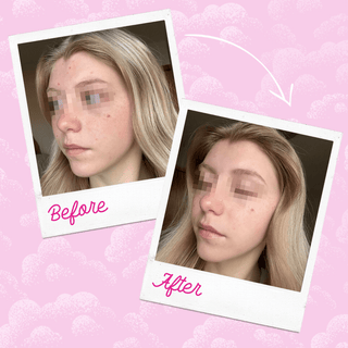 Silver Infused MakeUp Eraser PRO | Acne Prone Skin - Olita Gifts & Goods