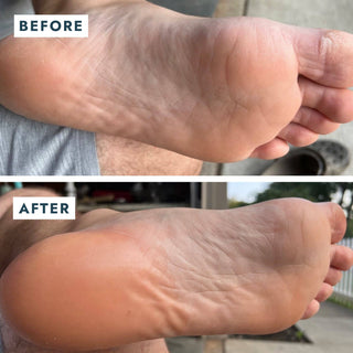 Solemate Heel Repair Balm - Olita Gifts & Goods