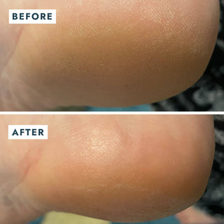 Solemate Heel Repair Balm - Olita Gifts & Goods