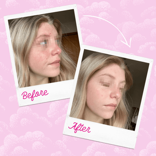 Silver Infused MakeUp Eraser PRO | Acne Prone Skin - Olita Gifts & Goods