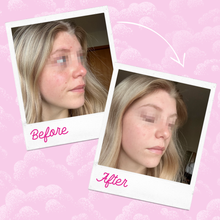 Load image into Gallery viewer, Silver Infused MakeUp Eraser PRO | Acne Prone Skin
