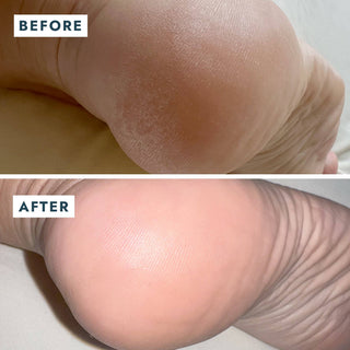 Solemate Heel Repair Balm - Olita Gifts & Goods